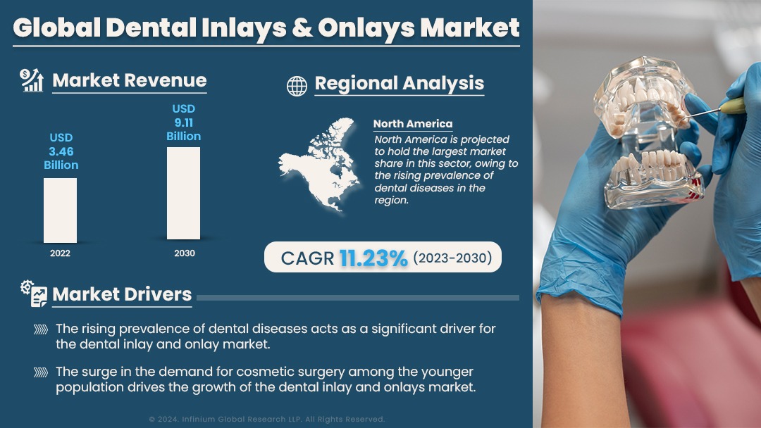 Dental Inlays & Onlays Market Size, Share, Trends, Industry  IGR
